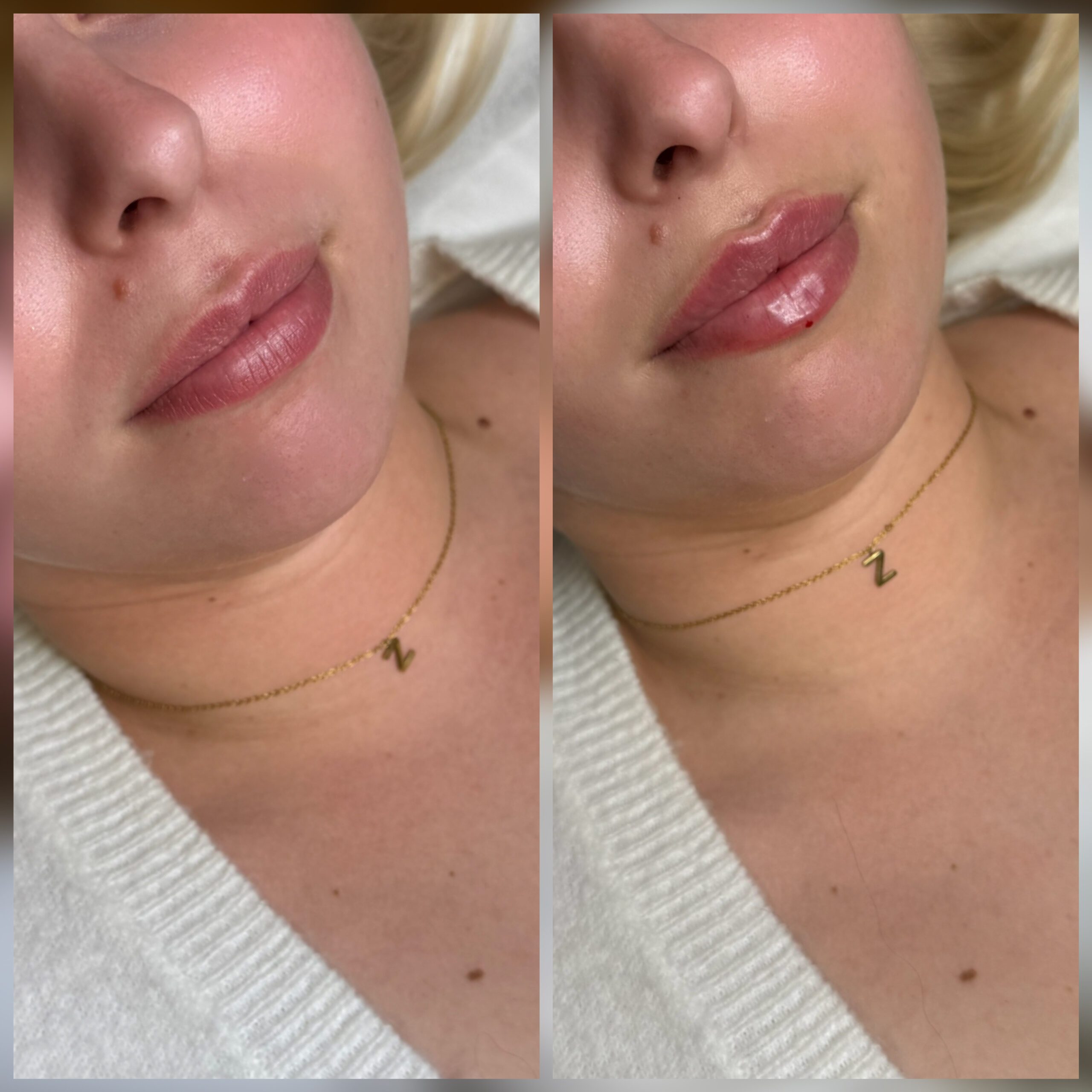 Fillers Västerås